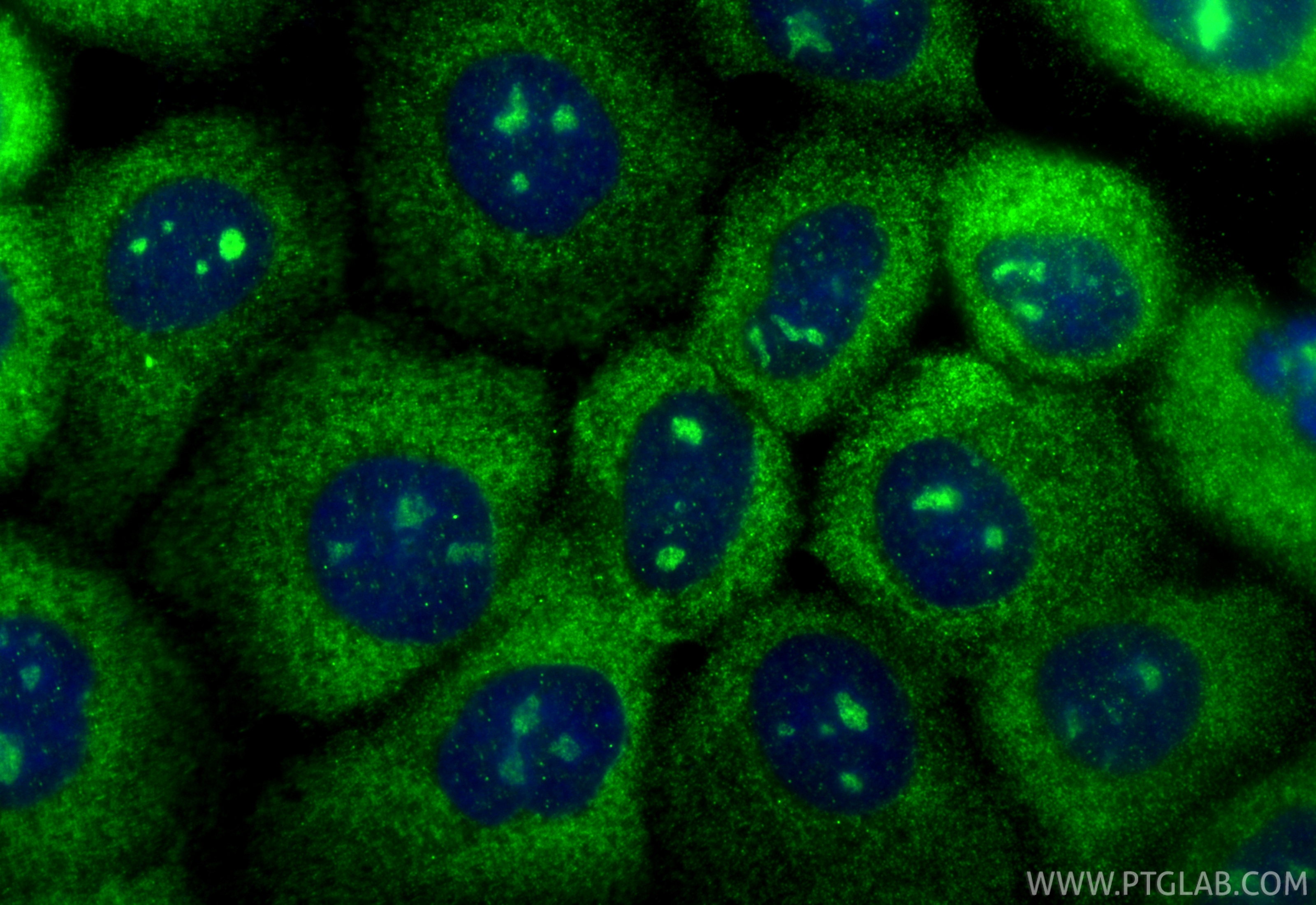 IF Staining of A431 using 27791-1-AP