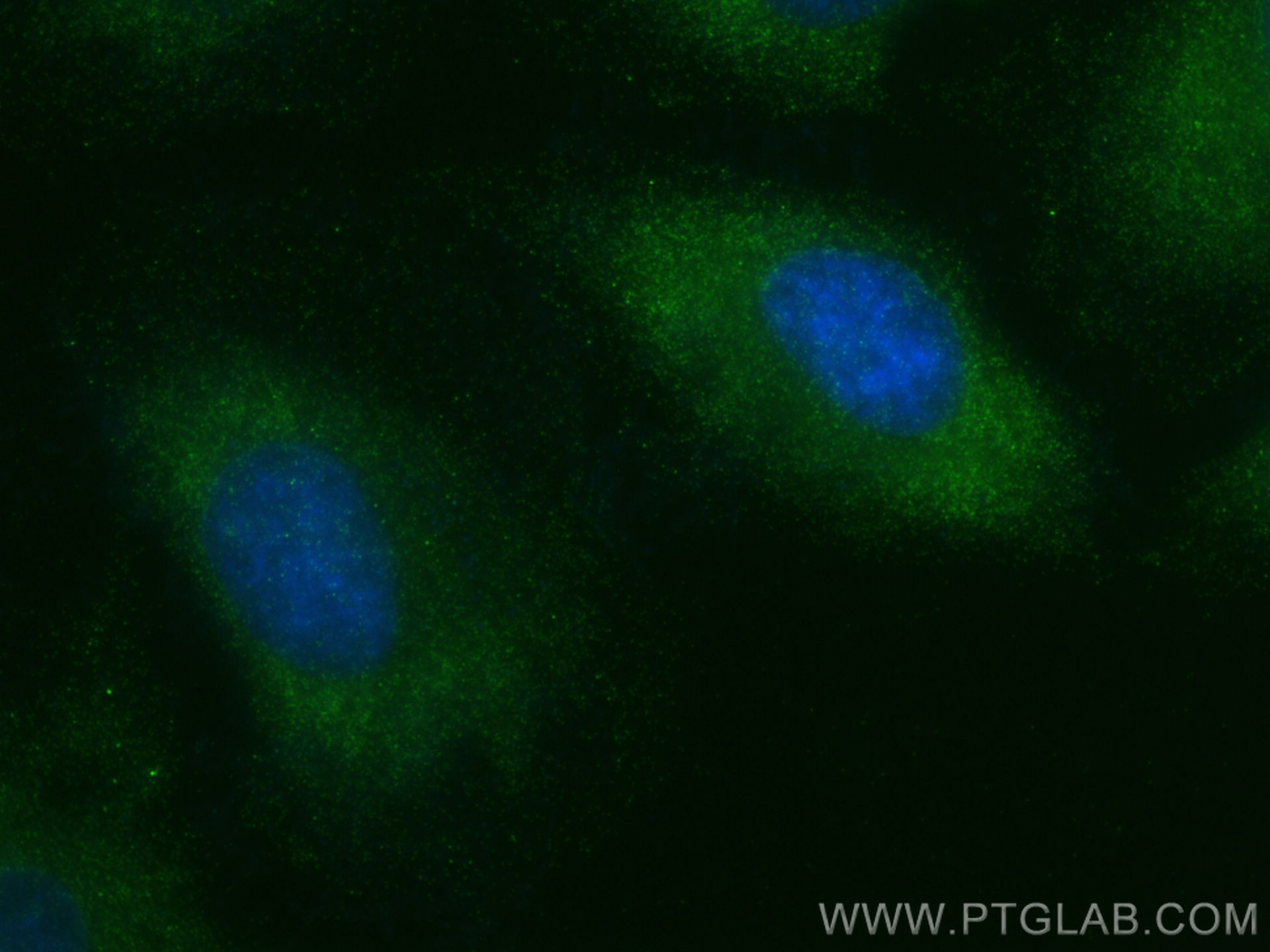 IF Staining of HeLa using 83172-2-RR