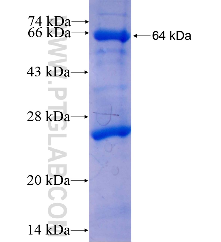 USP8 fusion protein Ag16602 SDS-PAGE USP8 fusion protein Ag16602 SDS-PAGE