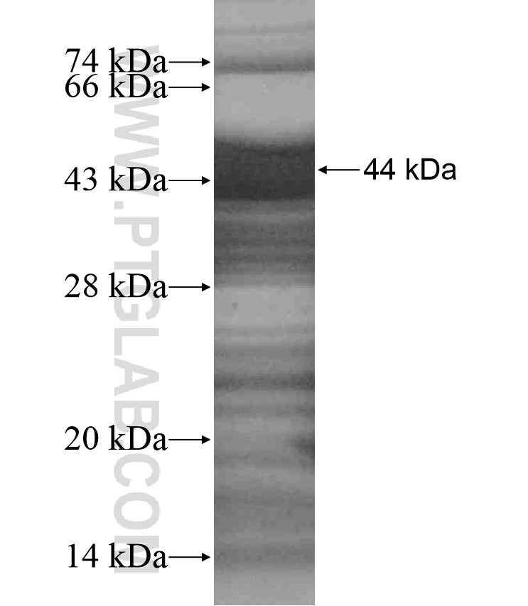 USP8 fusion protein Ag17977 SDS-PAGE USP8 fusion protein Ag17977 SDS-PAGE