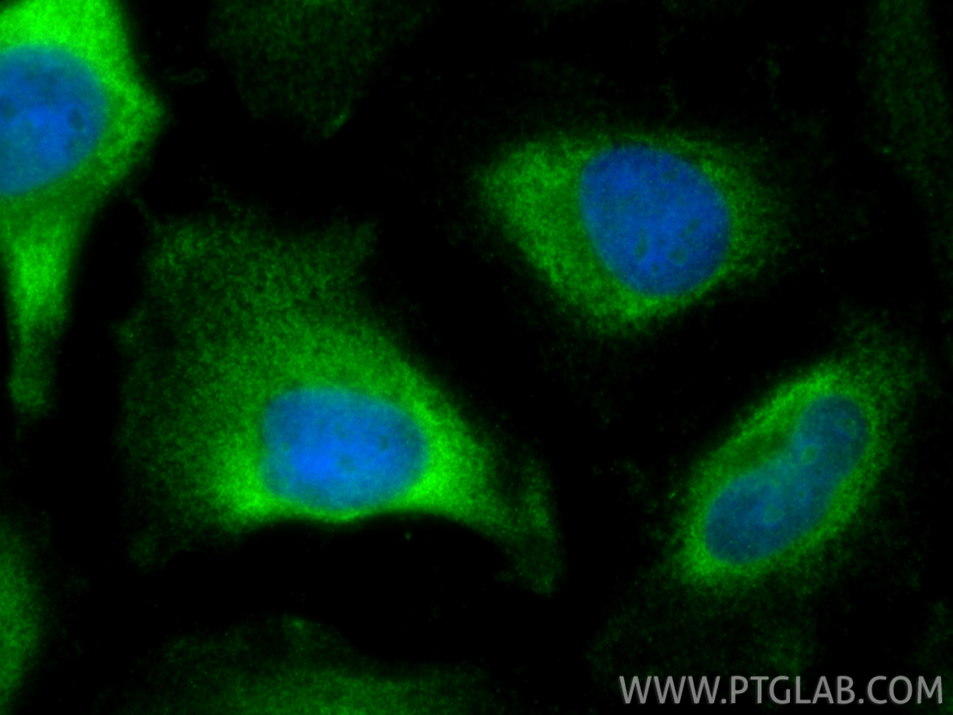 IF Staining of HeLa using 55054-1-AP