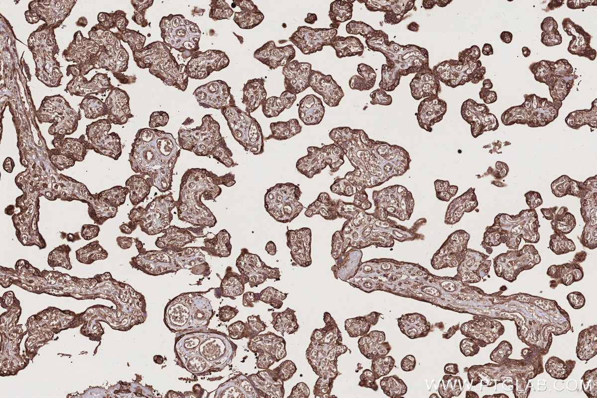 Immunohistochemical analysis of paraffin-embedded human placenta tissue slide using 55054-1-AP (USP9X antibody) at dilution of 1:1000 (under 10x lens). Heat mediated antigen retrieval with Tris-EDTA buffer (pH 9.0). IHC staining of human placenta using 55054-1-AP