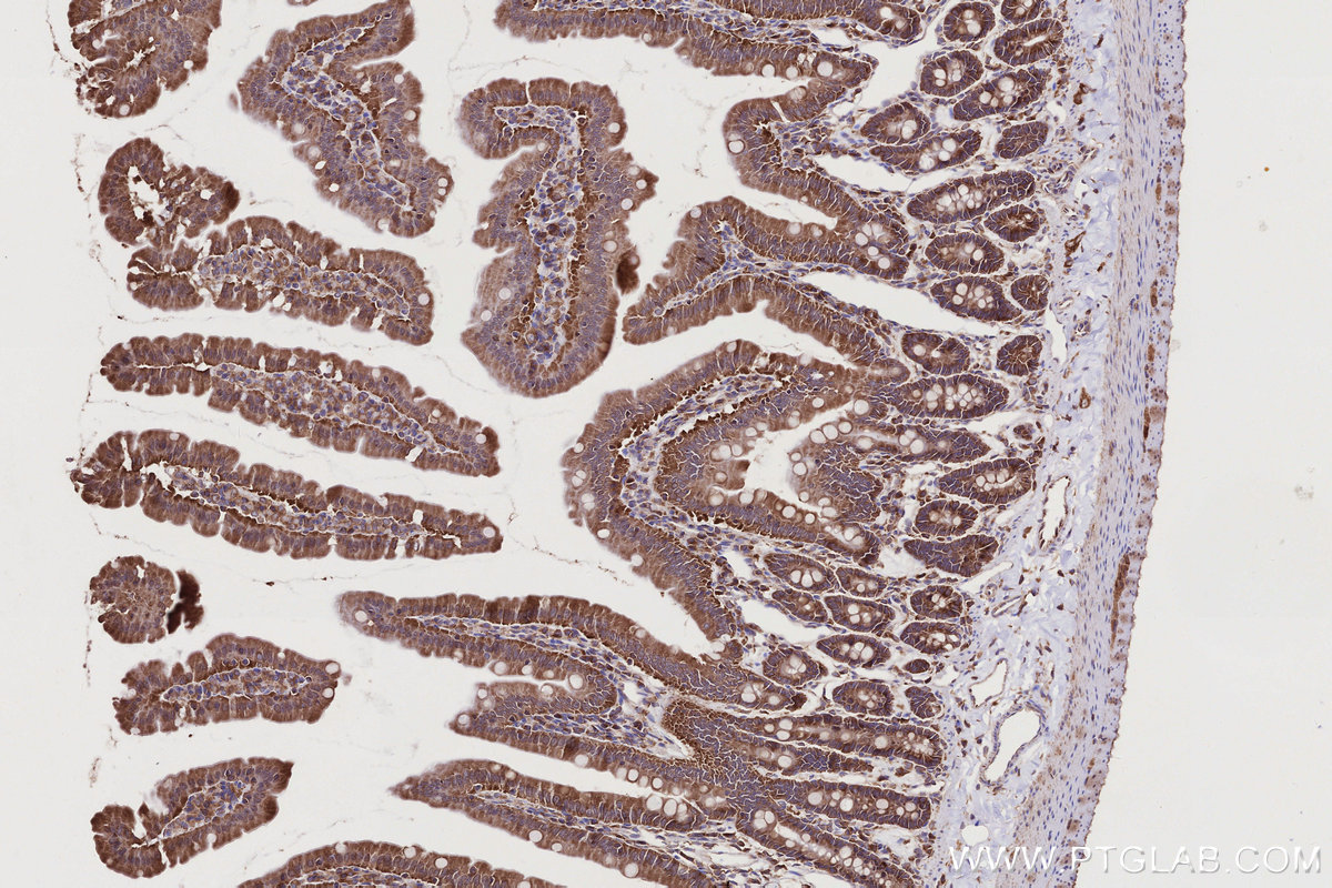 IHC staining of rat small intestine using 55054-1-AP IHC staining of rat small intestine using 55054-1-AP