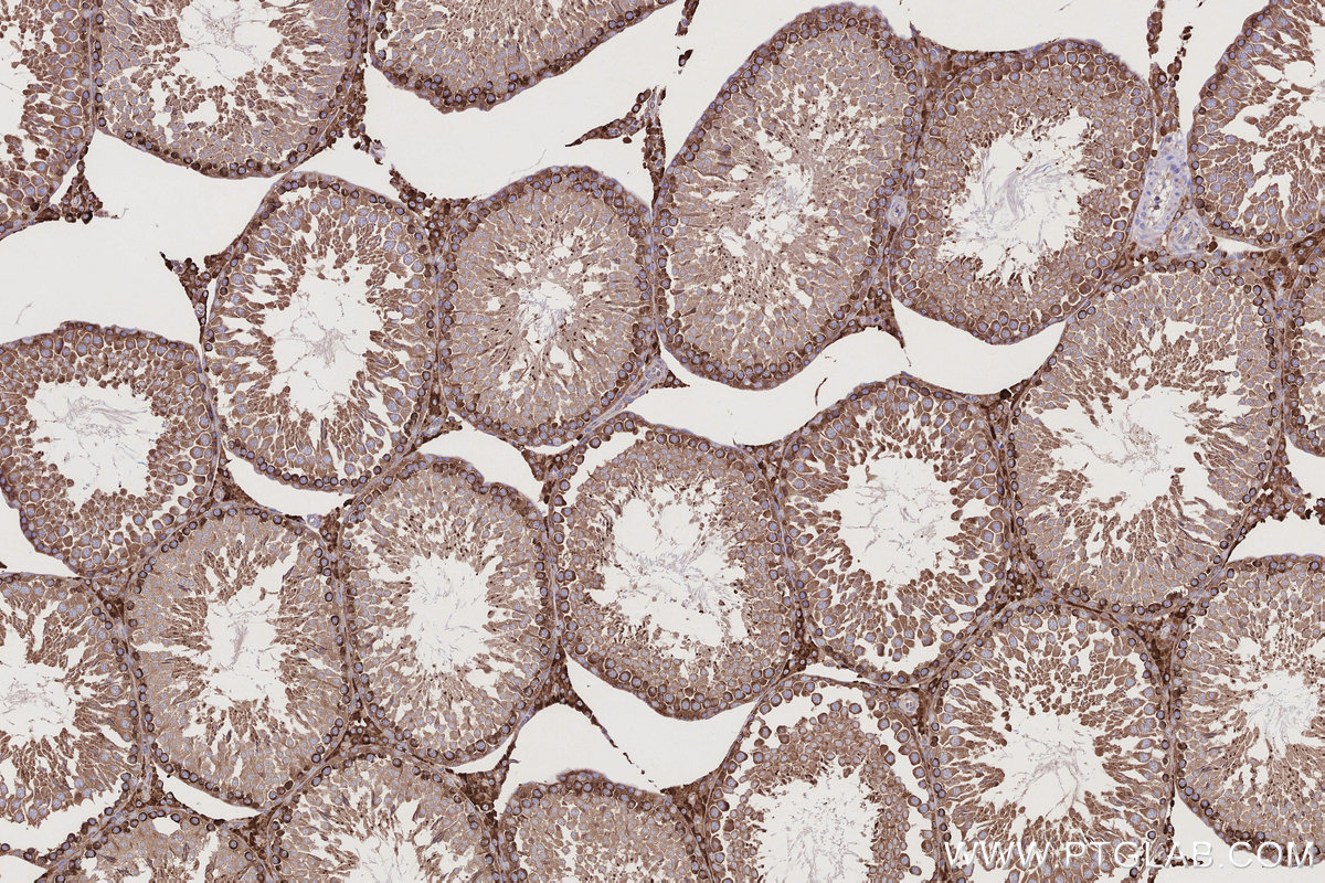 Immunohistochemical analysis of paraffin-embedded rat testis tissue slide using 55054-1-AP (USP9X antibody) at dilution of 1:1000 (under 10x lens). Heat mediated antigen retrieval with Tris-EDTA buffer (pH 9.0). IHC staining of rat testis using 55054-1-AP