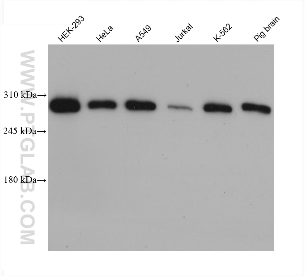 WB analysis using 68460-1-Ig