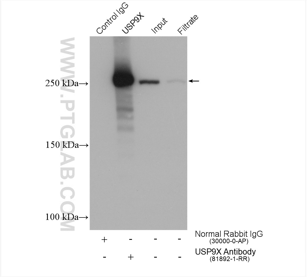 IP experiment of HEK-293 using 81892-1-RR