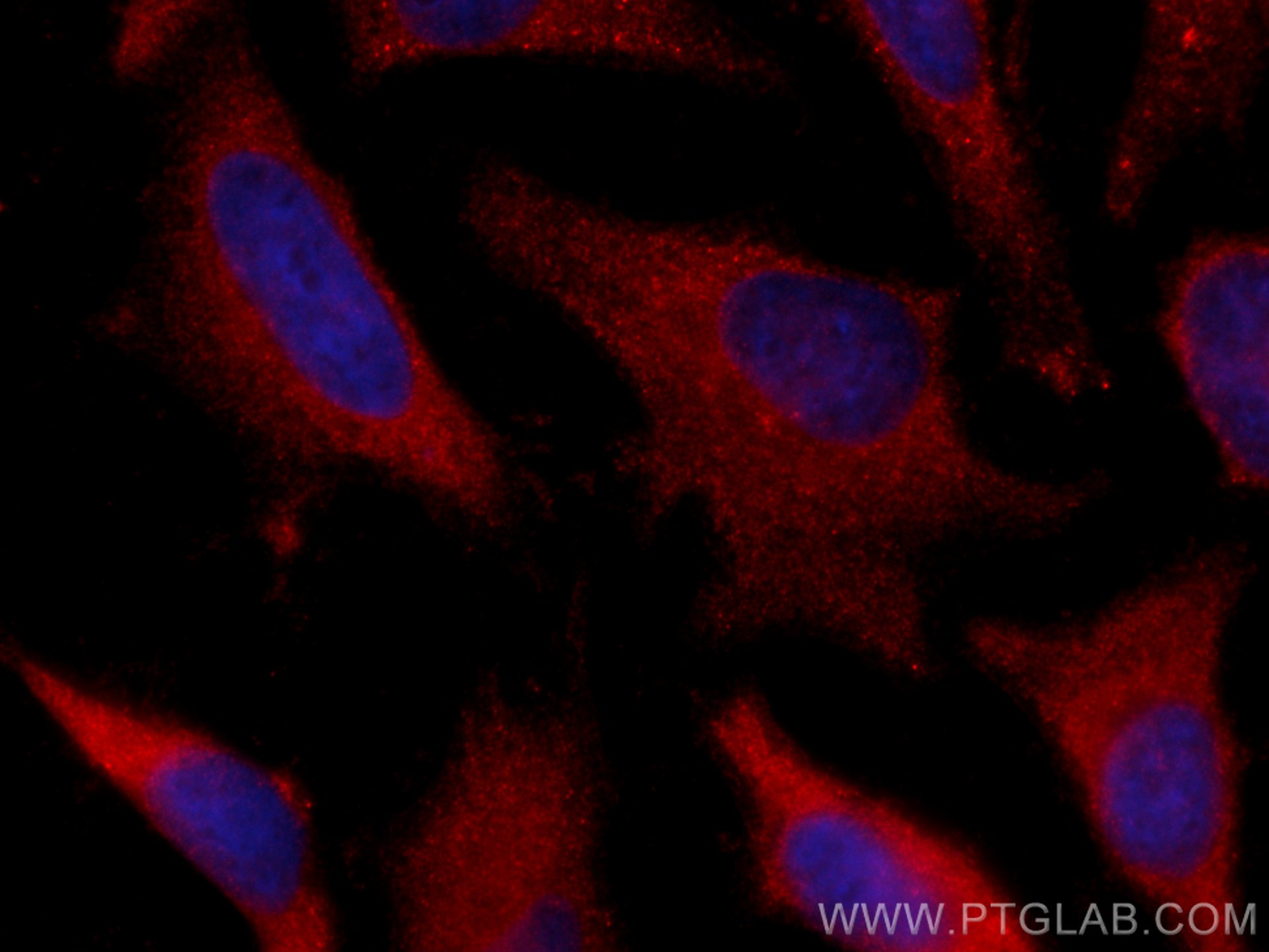 IF Staining of HeLa using CL594-55054