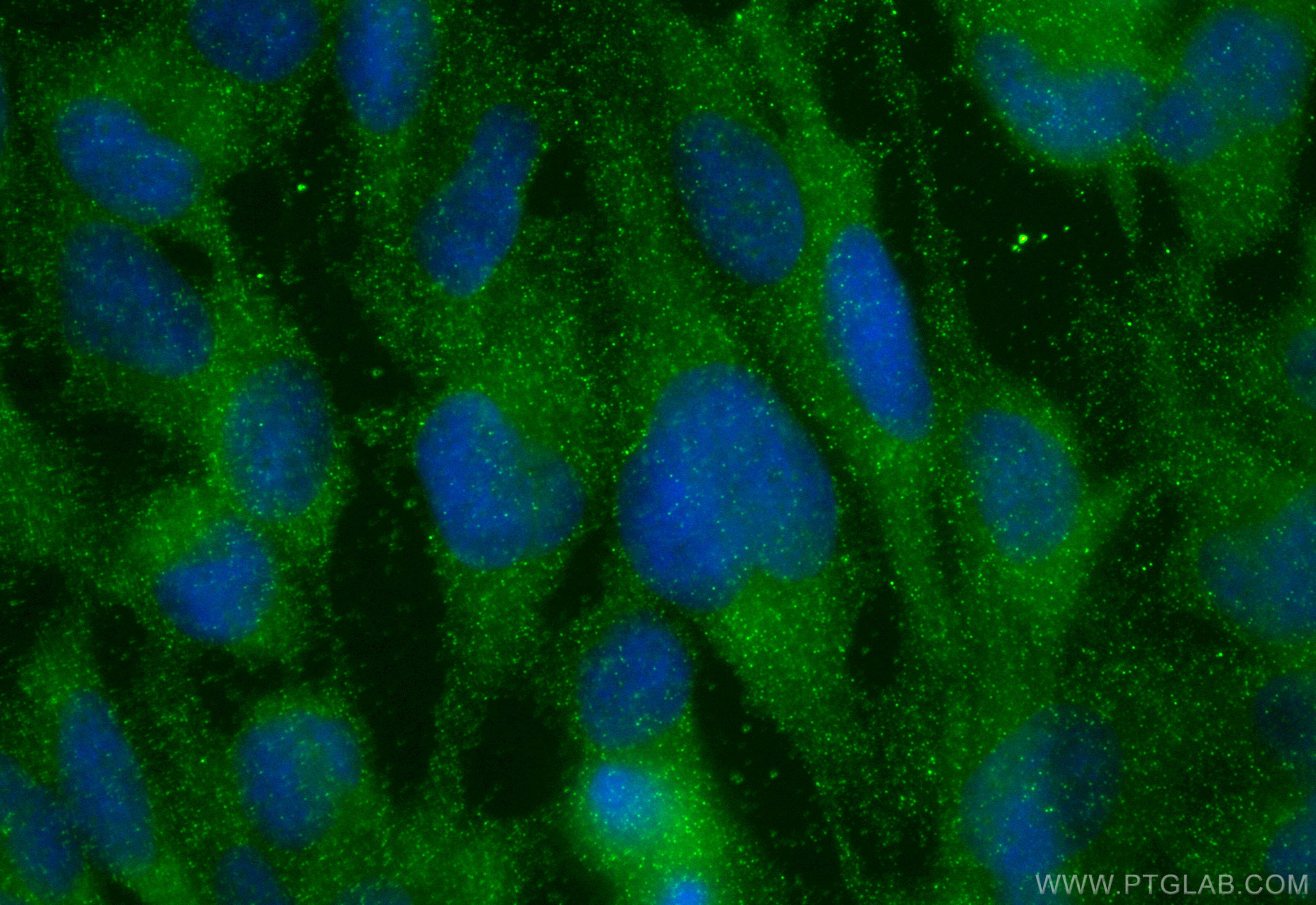 IF Staining of U-251 using 27578-1-AP