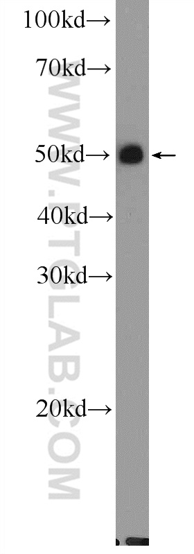 WB analysis of mouse kidney using 25962-1-AP