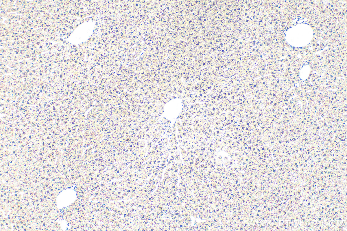 IHC staining of rat liver using 30456-1-AP (same clone as 30456-1-PBS)