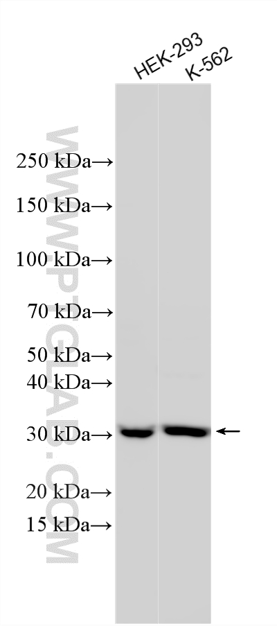 WB analysis using 31935-1-AP