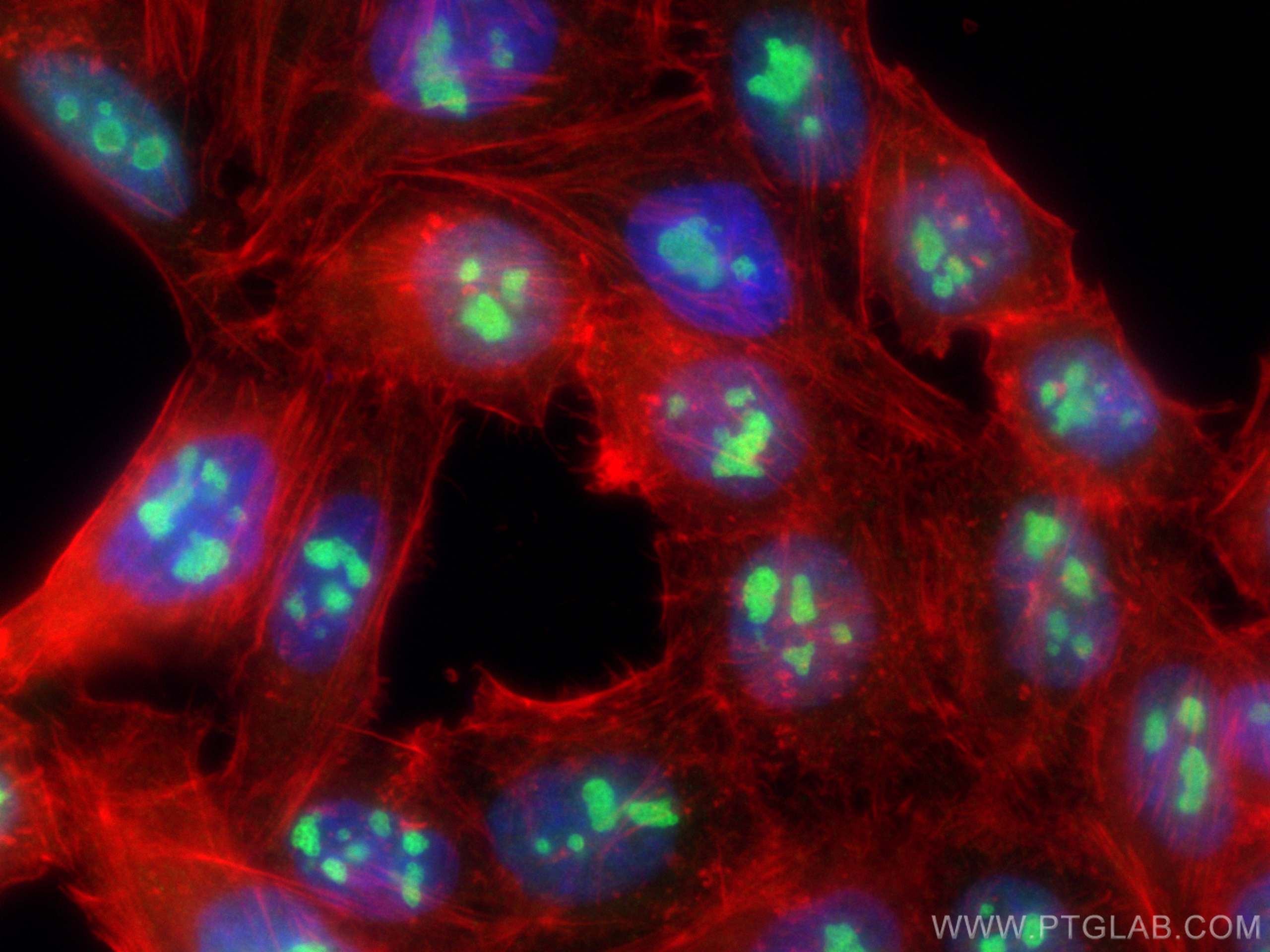 IF Staining of HepG2 using 11474-1-AP