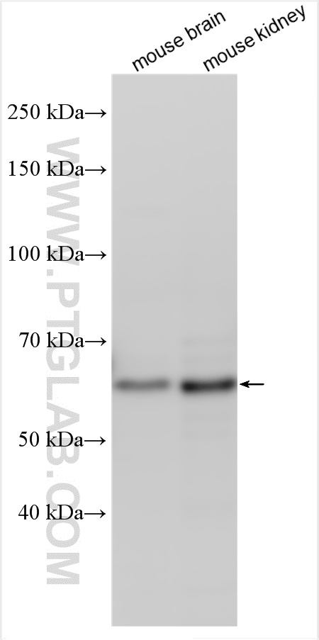 WB analysis using 31055-1-AP