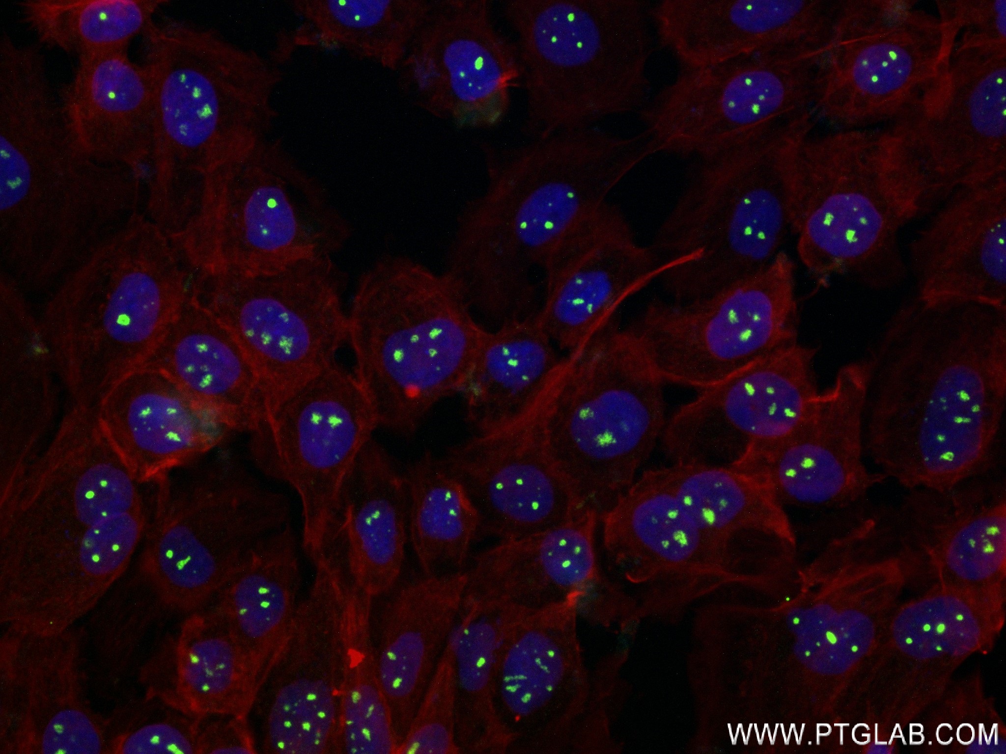 IF Staining of A431 using 84035-3-RR (same clone as 84035-3-PBS)