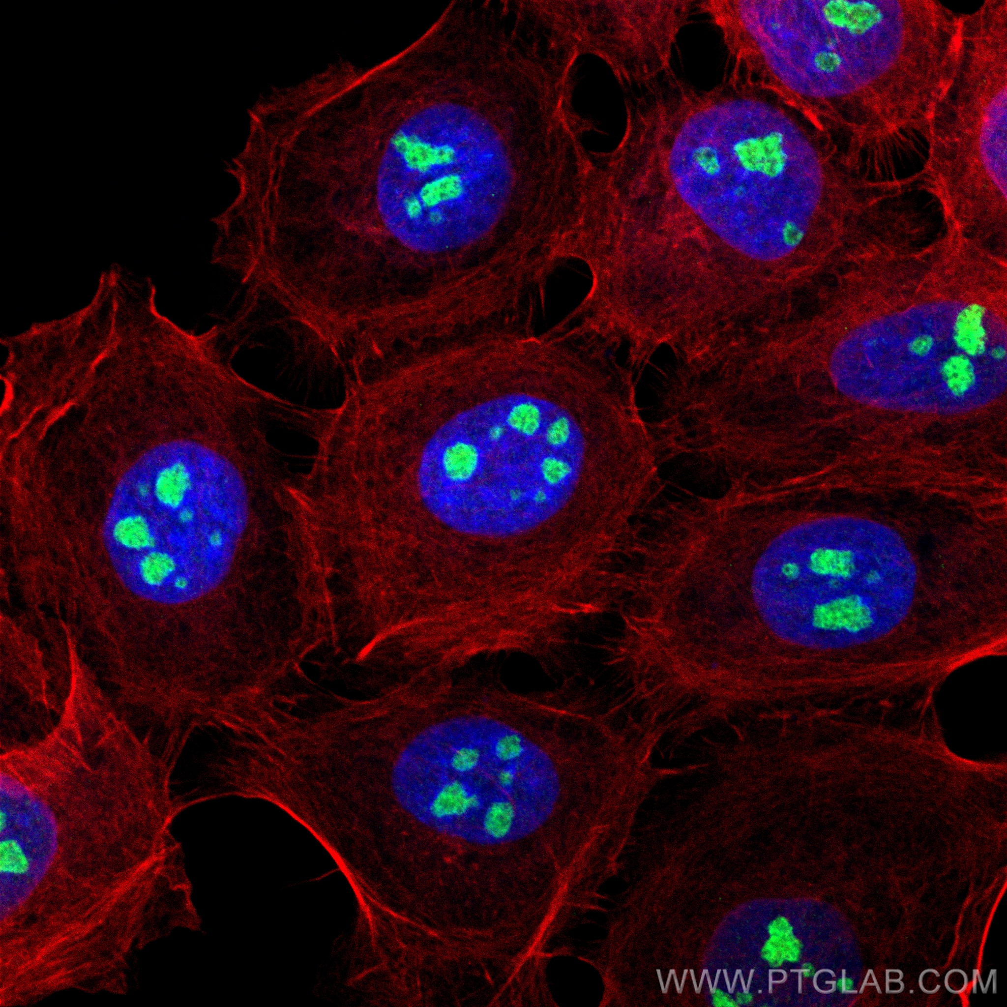 IF Staining of A431 using 84035-3-RR (same clone as 84035-3-PBS)