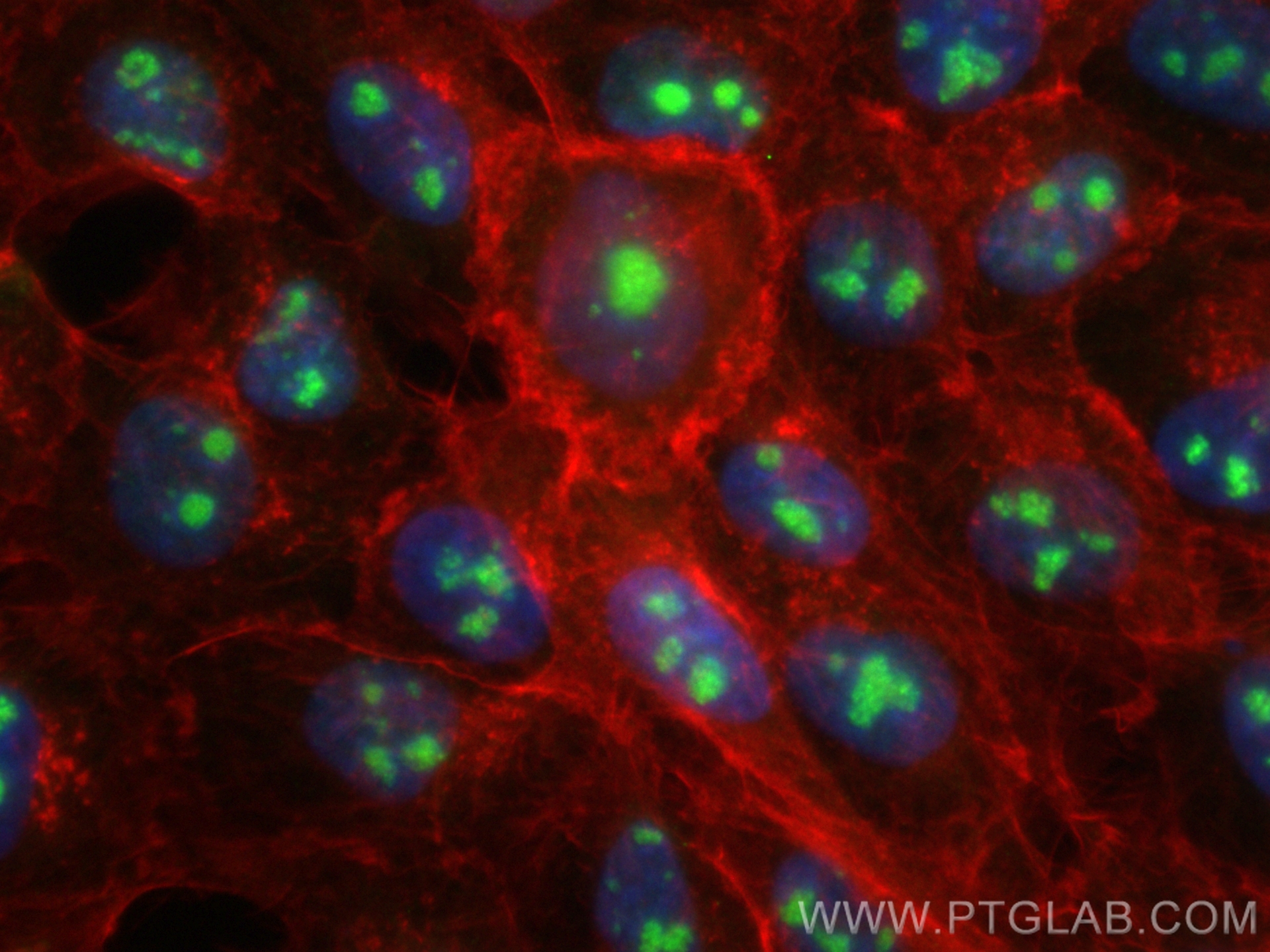 IF Staining of A431 using CL488-84035-3