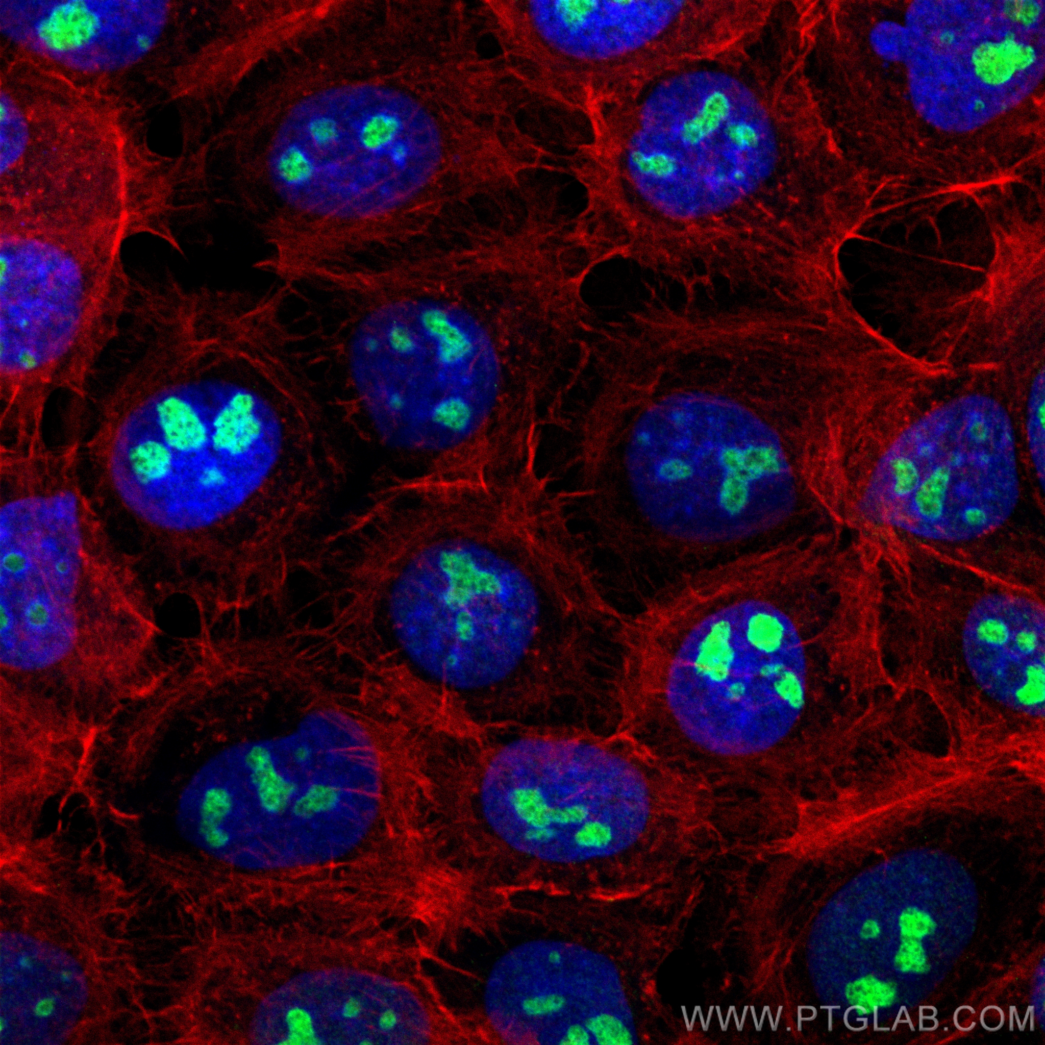 IF Staining of A431 using CL488-84035-3