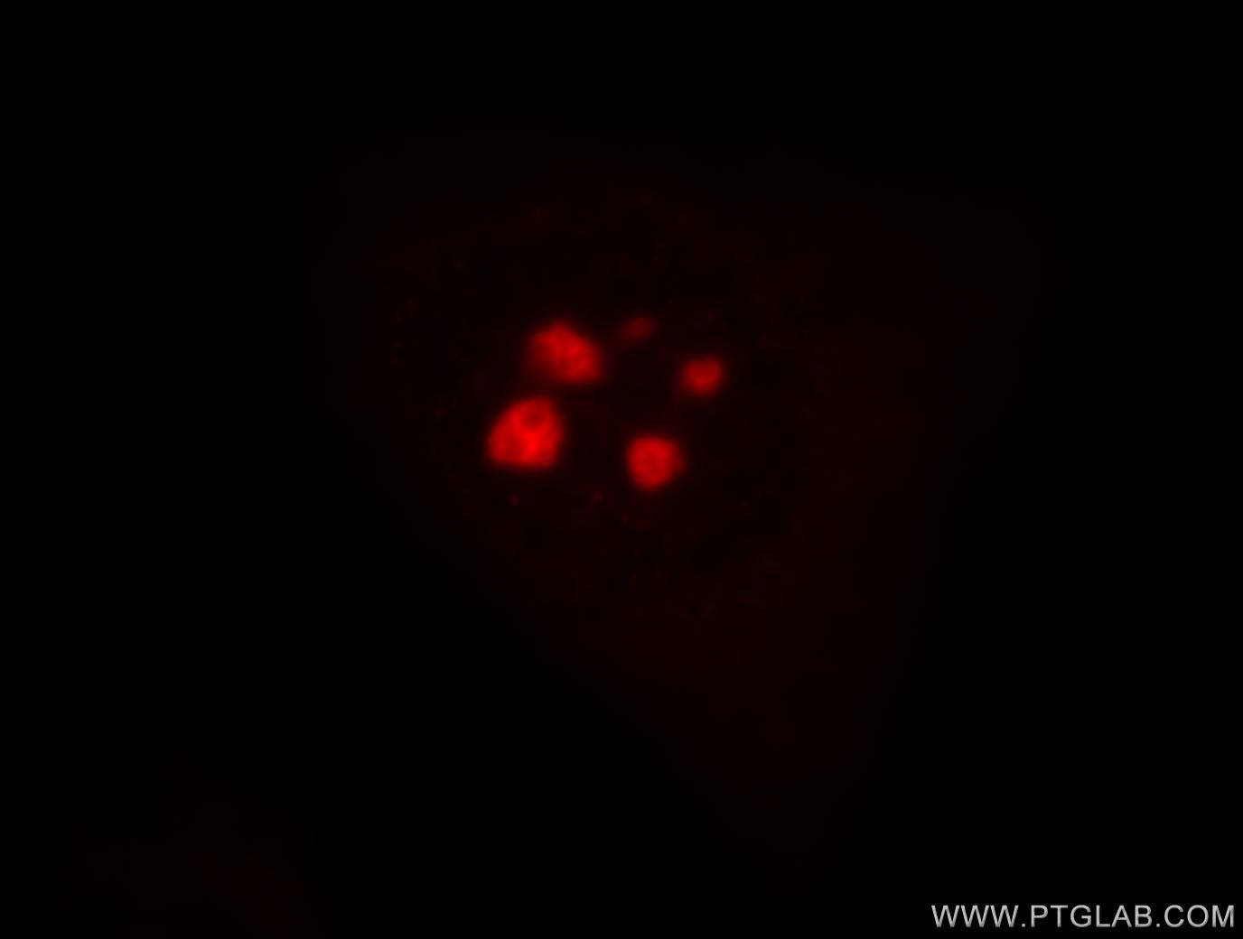 IF Staining of HeLa using 18830-1-AP