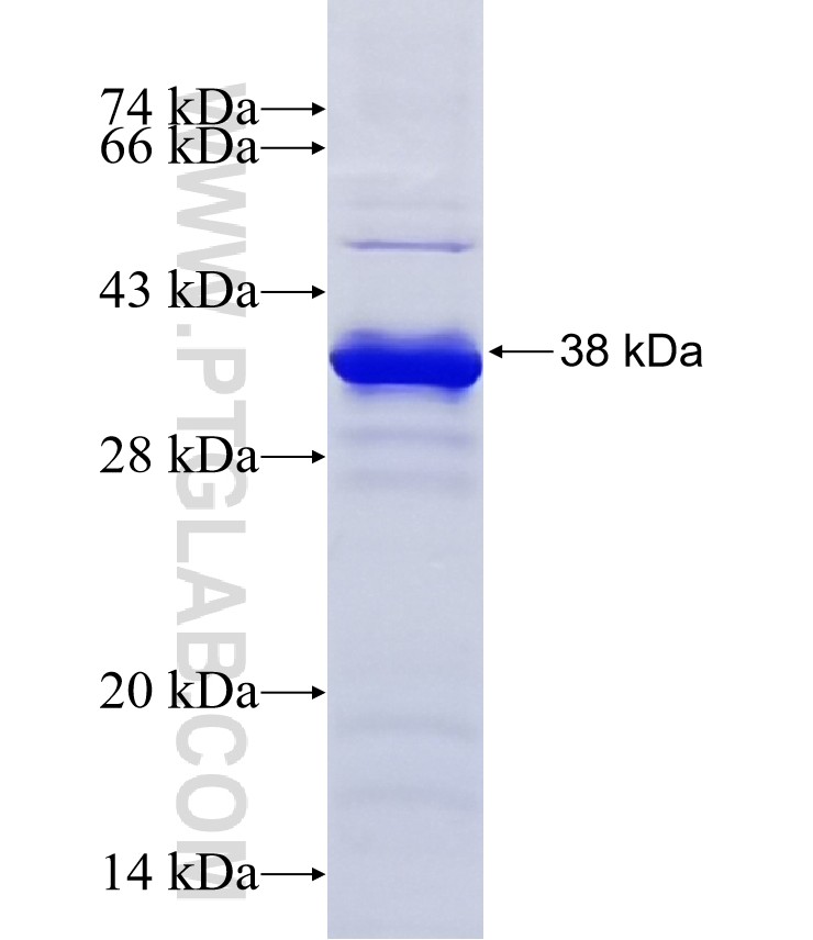 UTP23 fusion protein Ag8524 SDS-PAGE UTP23 fusion protein Ag8524 SDS-PAGE