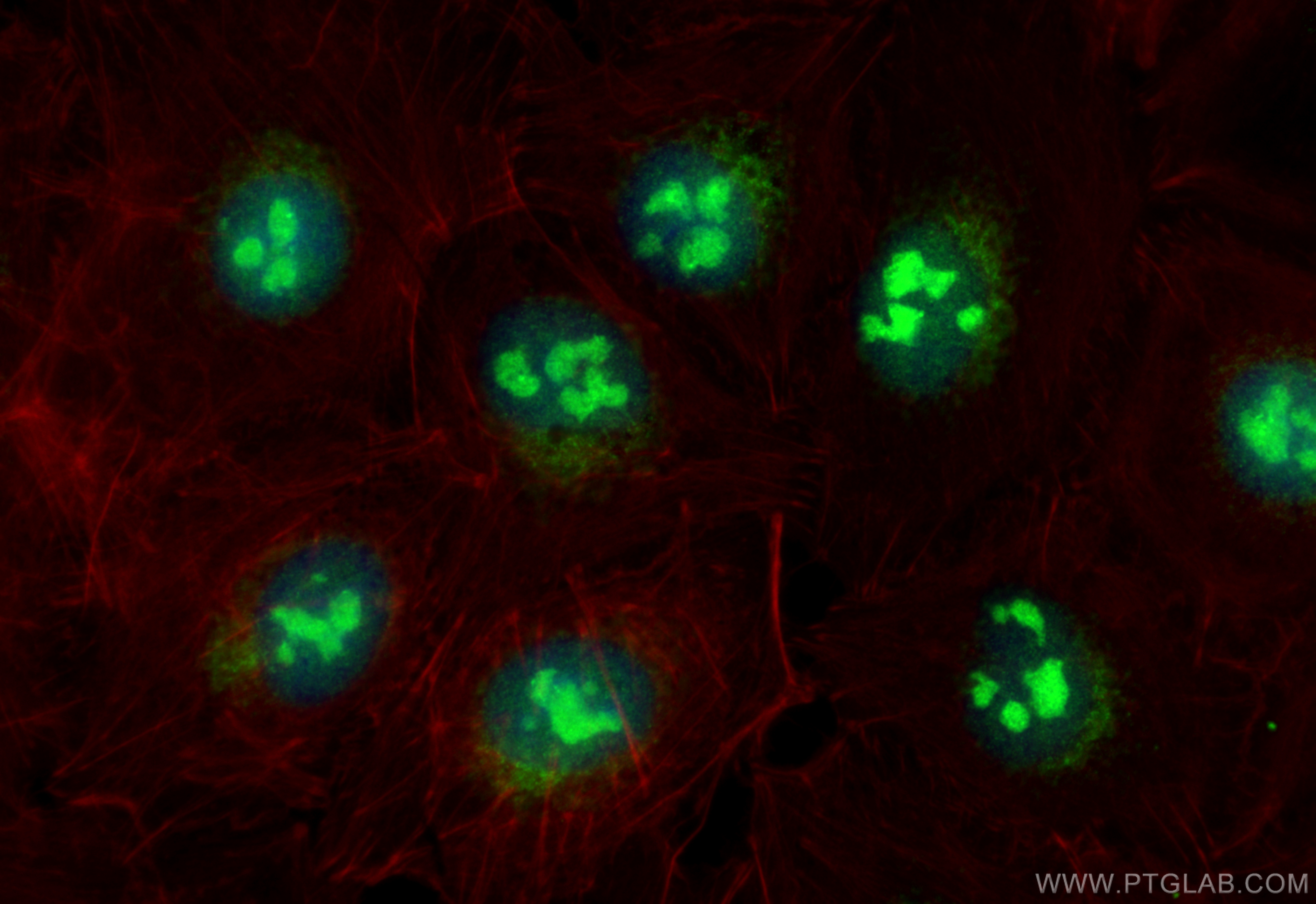 IF Staining of A549 using 18886-1-AP