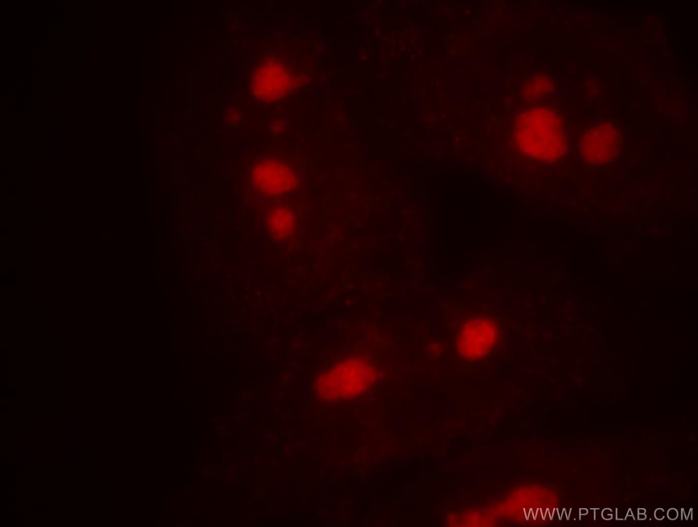 IF Staining of HepG2 using 18886-1-AP (same clone as 18886-1-PBS)