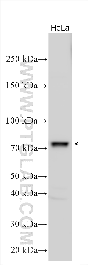 WB analysis using 18886-1-AP