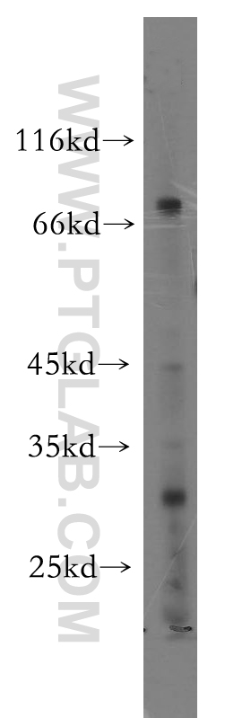 WB analysis of A549 using 18886-1-AP (same clone as 18886-1-PBS)