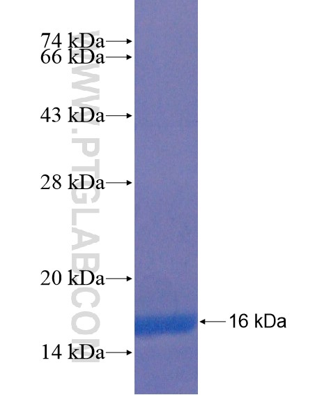 UTS2R fusion protein Ag21618 SDS-PAGE