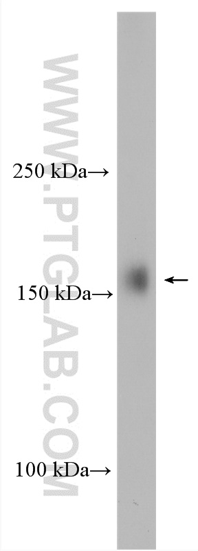 WB analysis of HepG2 using 23984-1-AP