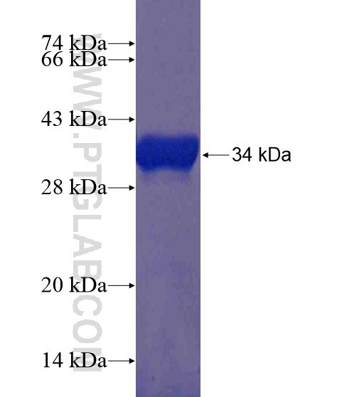 UTX fusion protein Ag21373 SDS-PAGE UTX fusion protein Ag21373 SDS-PAGE