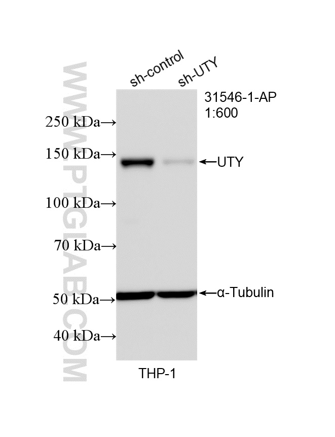 WB analysis of THP-1 using 31546-1-AP (same clone as 31546-1-PBS)