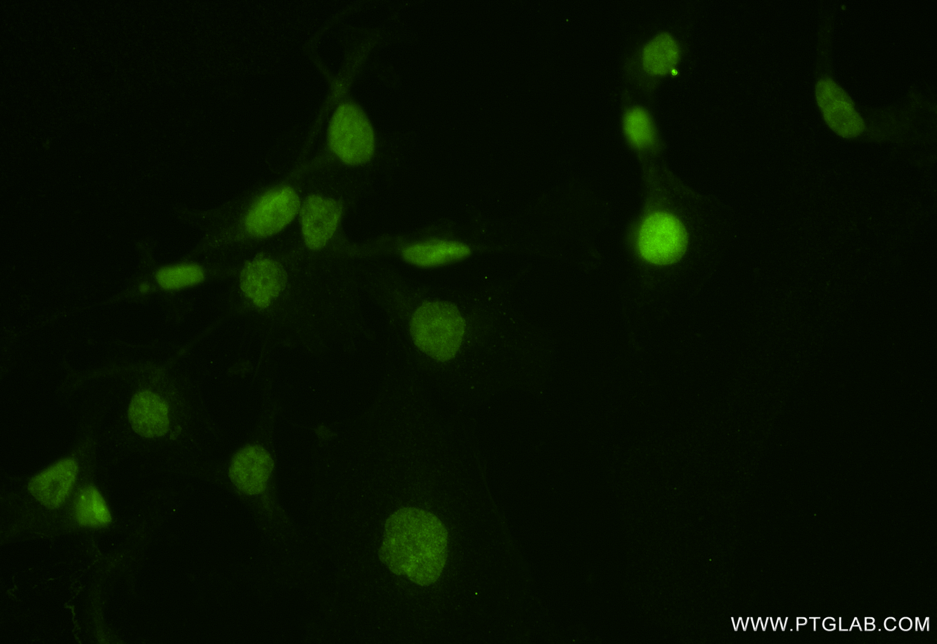 IF Staining of MDA-MB-231 using 84332-5-RR