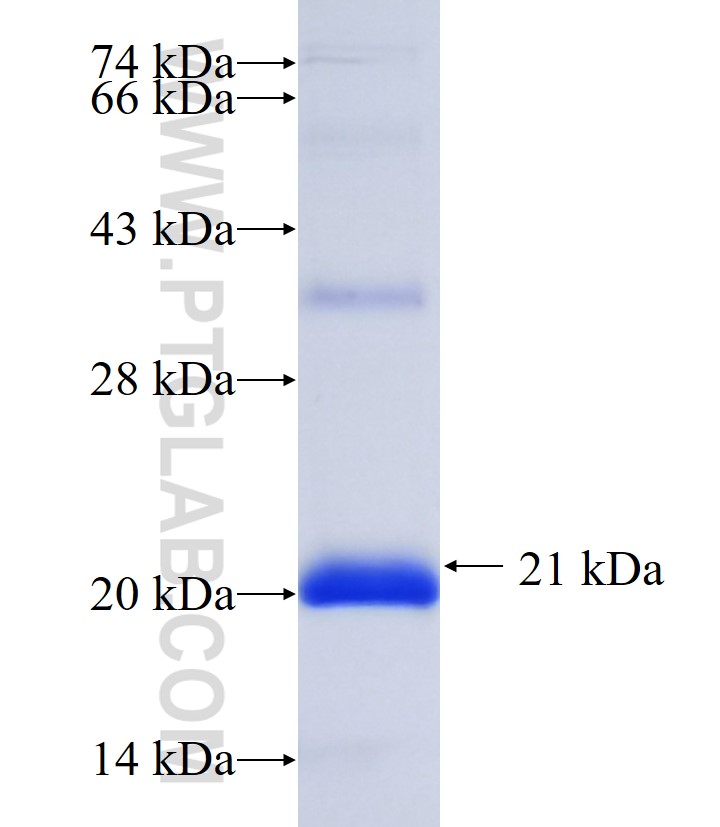 UTY fusion protein Ag35842 SDS-PAGE