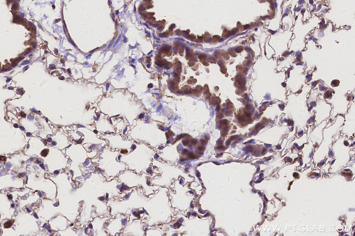 IHC staining of mouse lung using 29190-1-AP IHC staining of mouse lung using 29190-1-AP