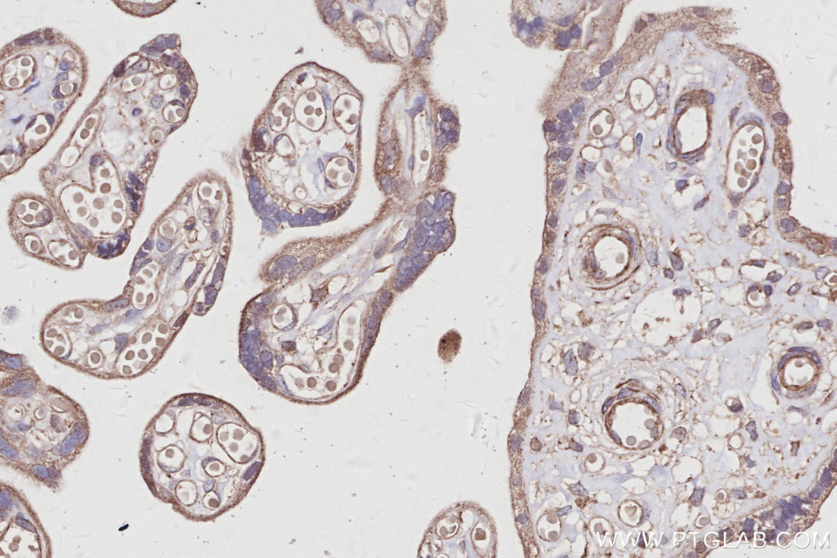 IHC staining of human placenta using 29190-1-AP IHC staining of human placenta using 29190-1-AP