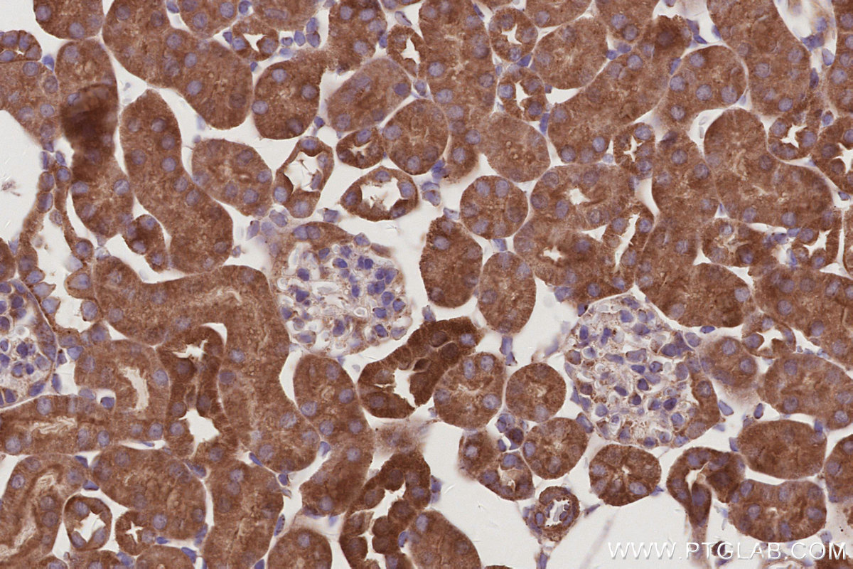 IHC staining of mouse kidney using 29190-1-AP IHC staining of mouse kidney using 29190-1-AP