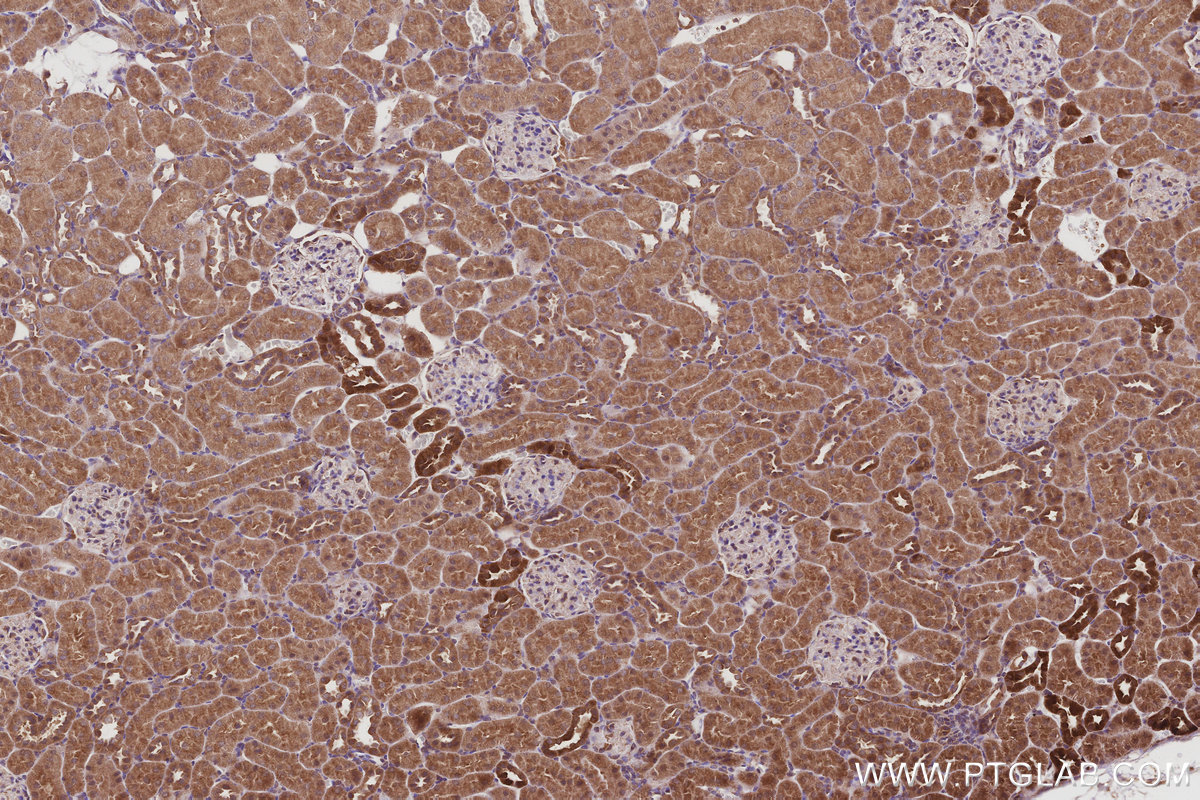IHC staining of rat kidney using 29190-1-AP IHC staining of rat kidney using 29190-1-AP