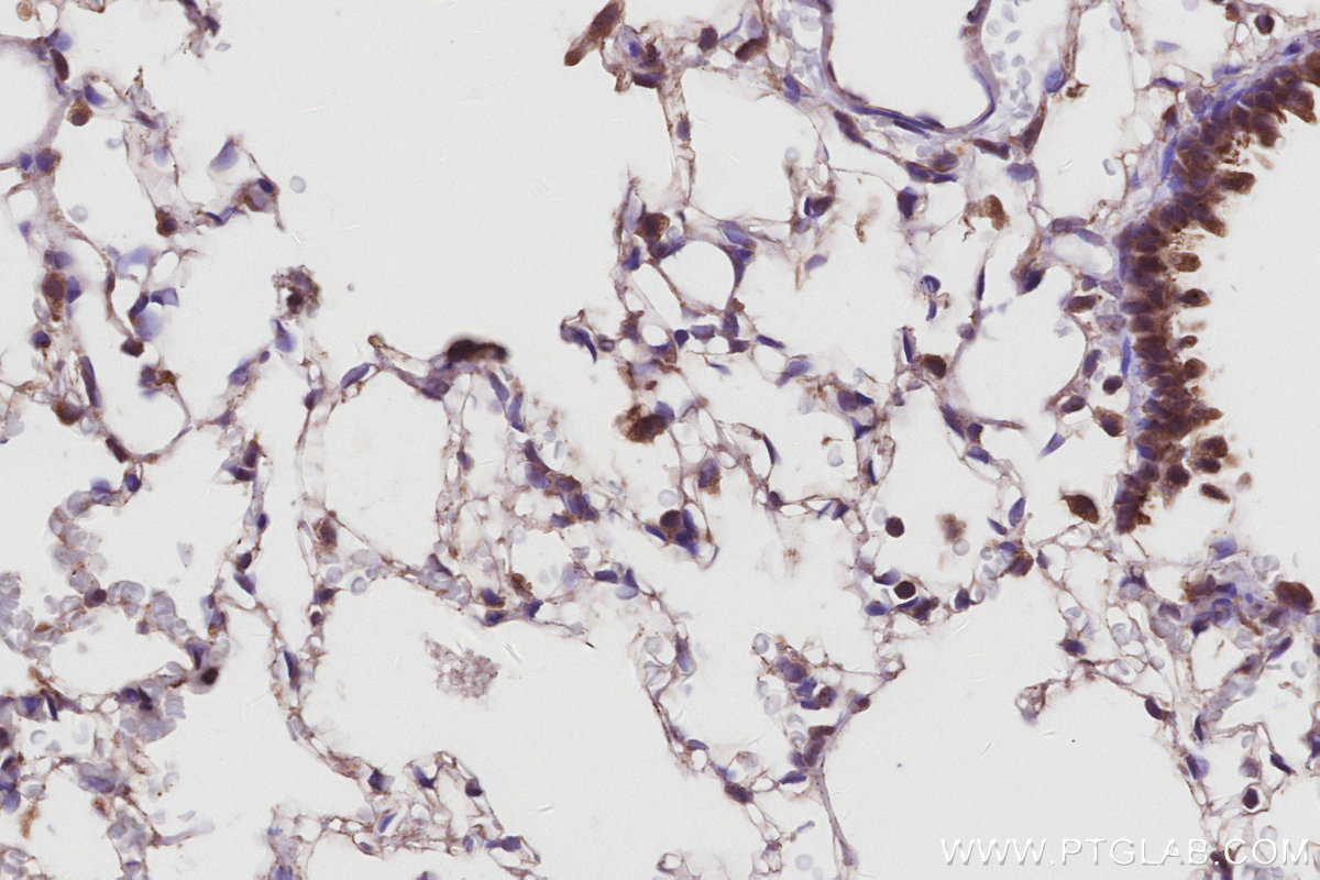 IHC staining of rat lung using 29190-1-AP IHC staining of rat lung using 29190-1-AP
