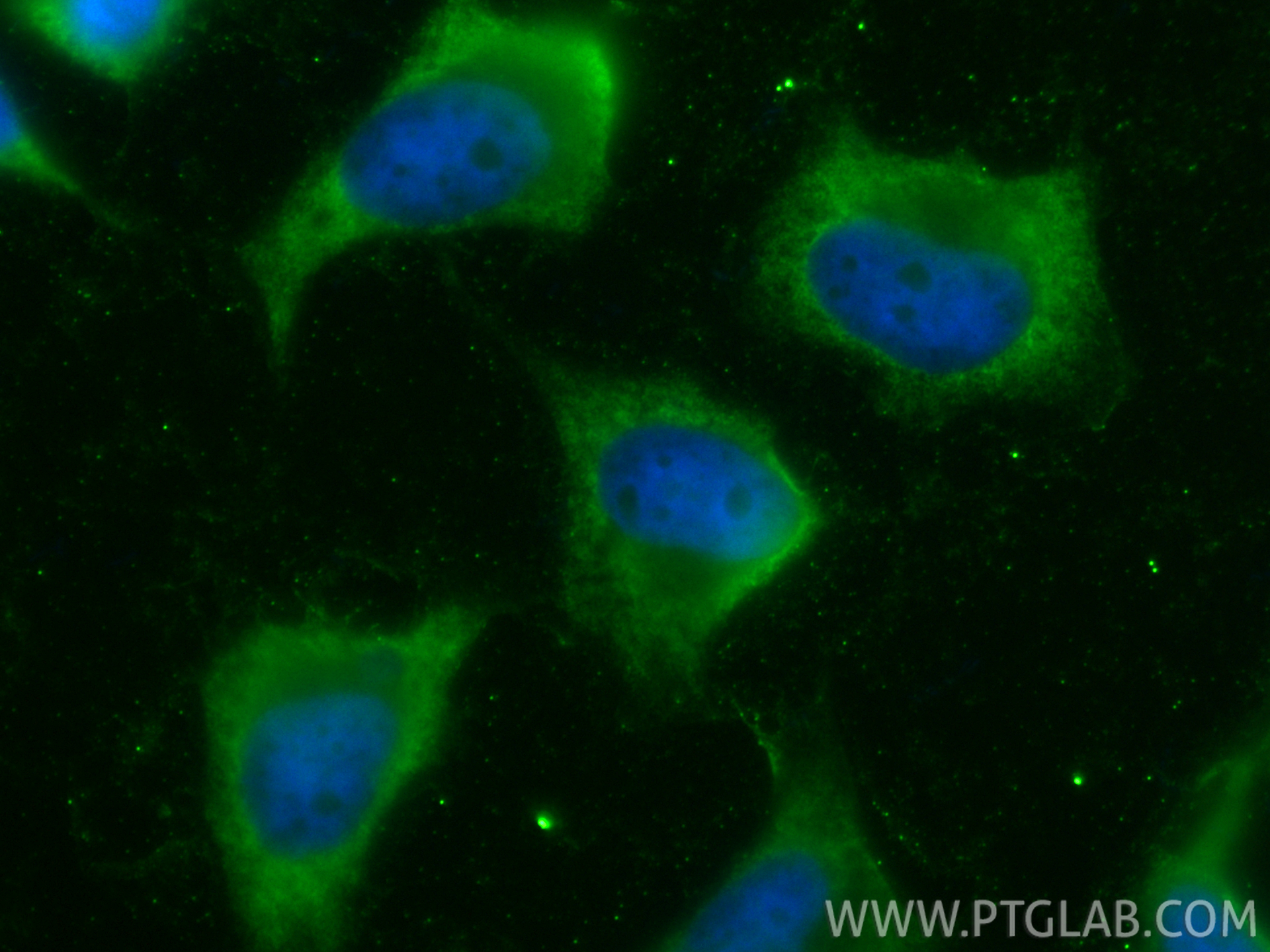 IF Staining of HeLa using CL488-84649-2 IF Staining of HeLa using CL488-84649-2