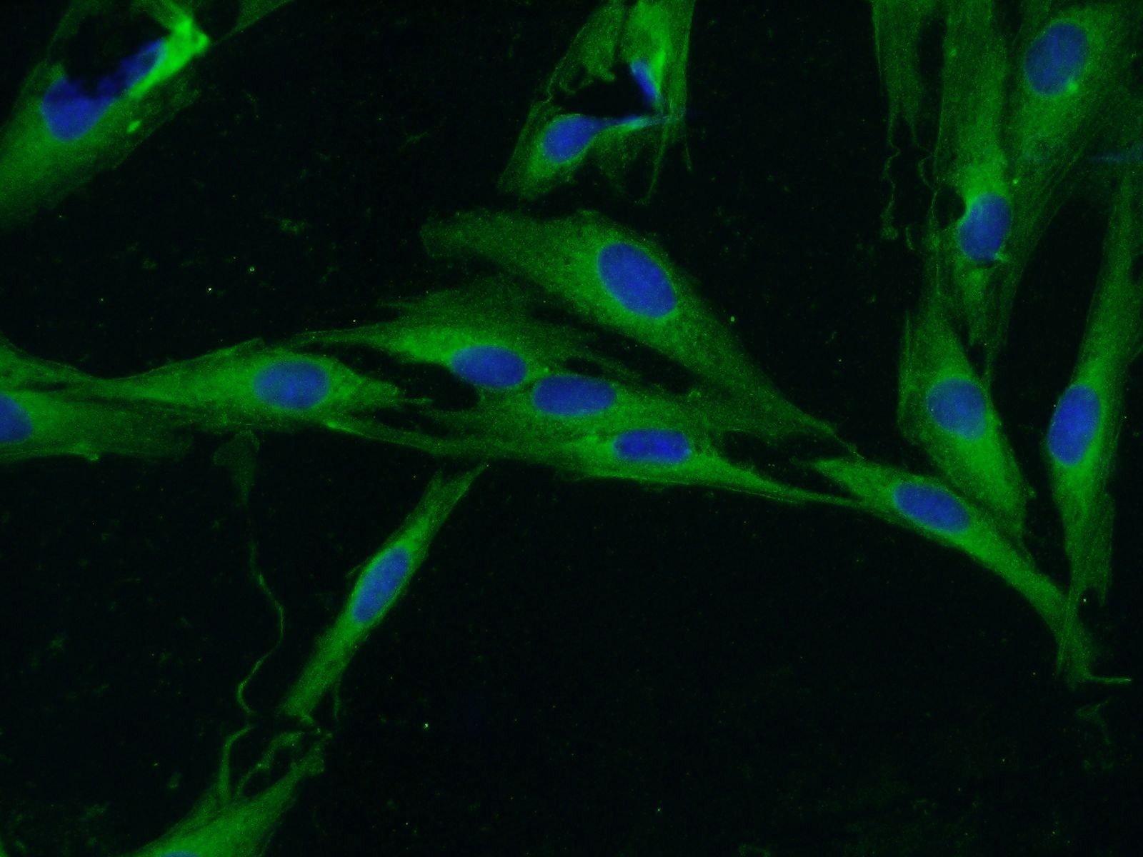 IF Staining of MDCK using 26201-1-AP