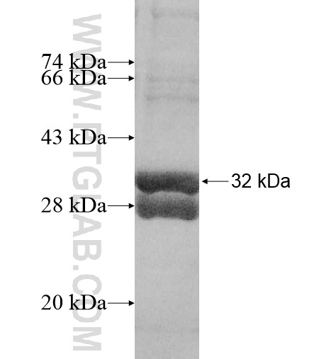 Upk2 fusion protein Ag10378 SDS-PAGE Upk2 fusion protein Ag10378 SDS-PAGE