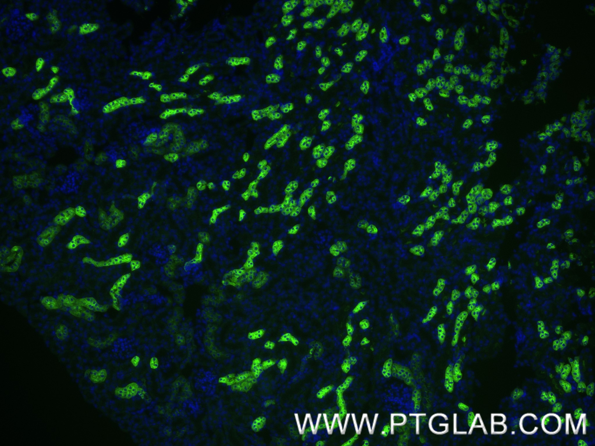 IF Staining of mouse kidney using 85597-4-RR