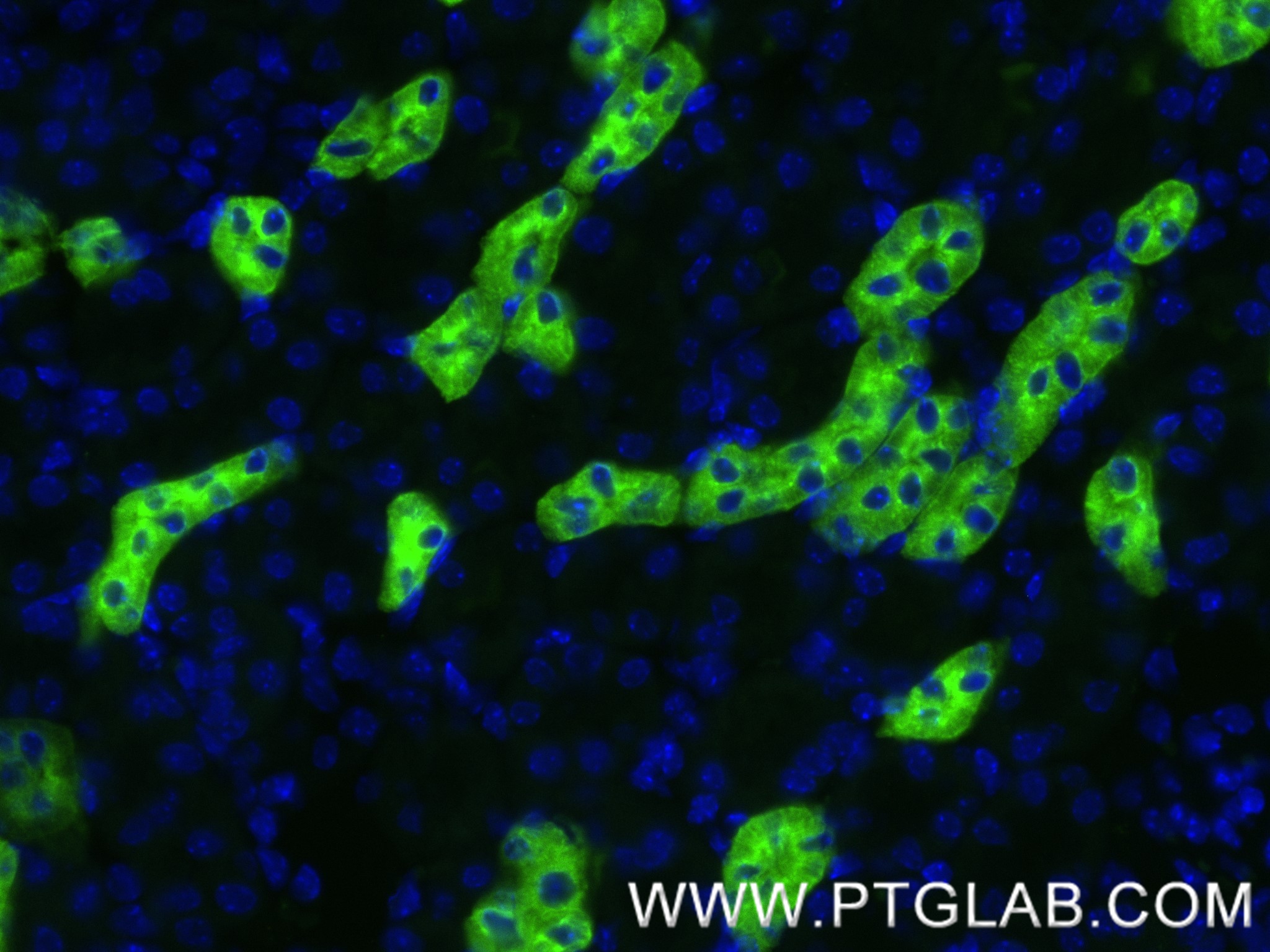 IF Staining of mouse kidney using 85597-4-RR