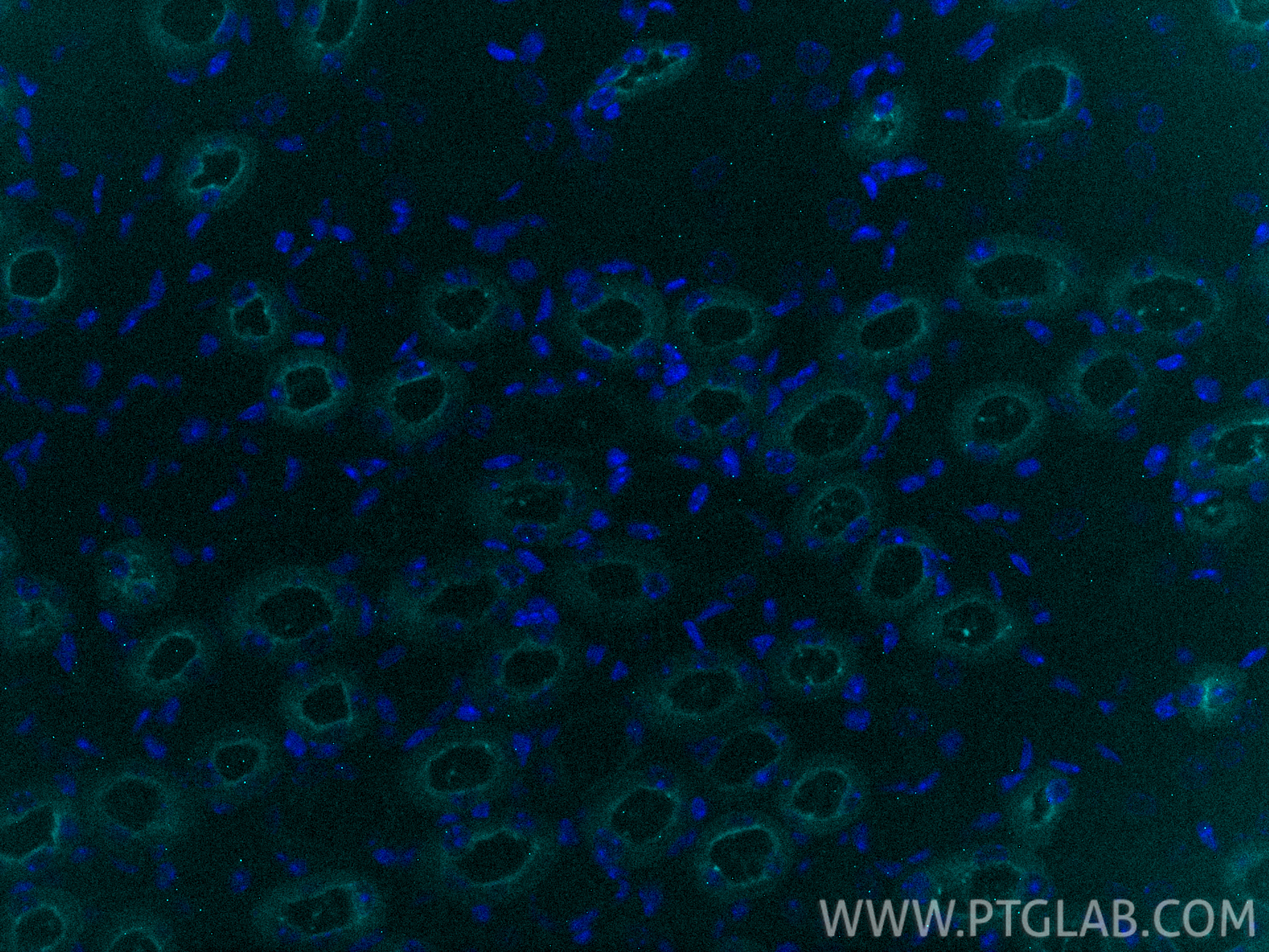 IF Staining of mouse kidney using CL750-85597-4