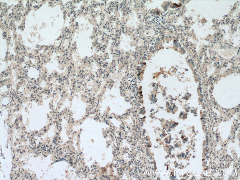 IHC staining of human lung using 26909-1-AP
