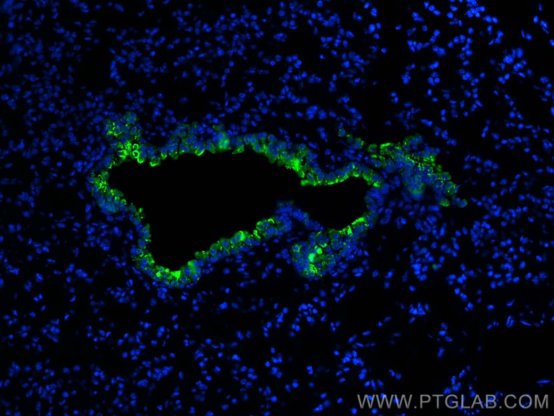 IF Staining of mouse lung using CL488-10490