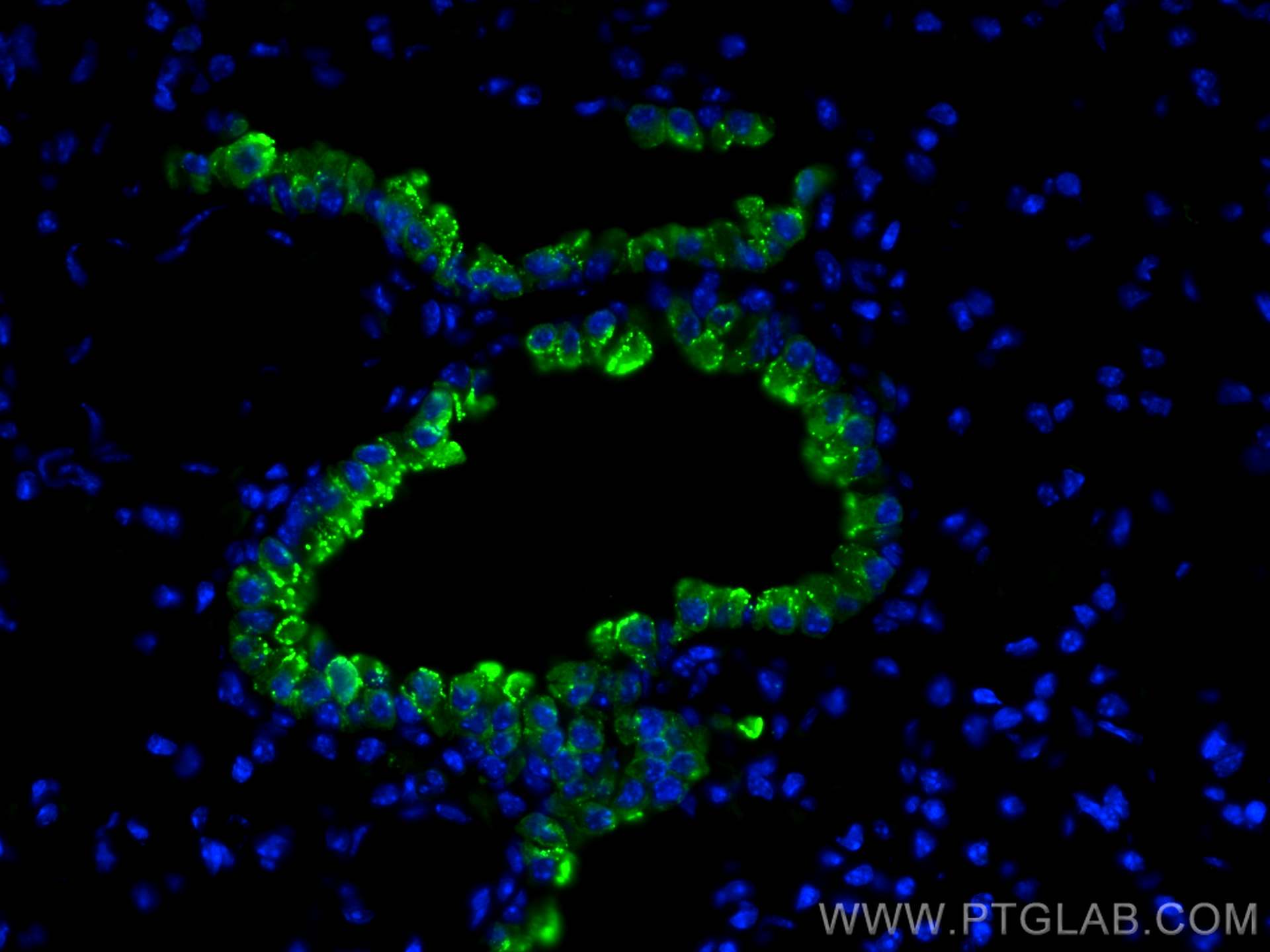 IF Staining of mouse lung using CL488-10490