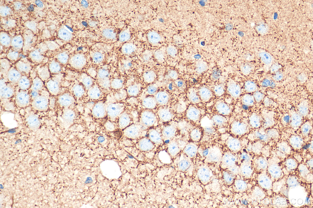 IHC staining of mouse brain using 13115-1-AP