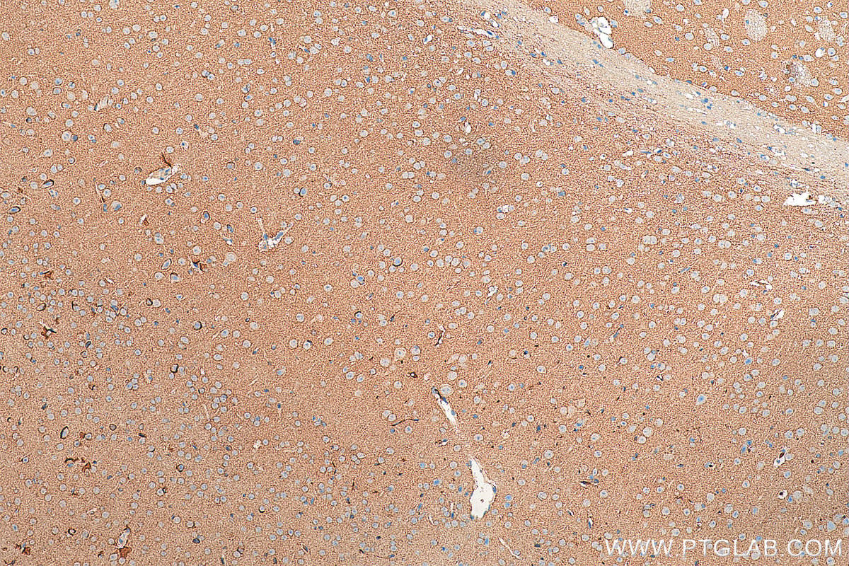 IHC staining of mouse brain using 10135-1-AP