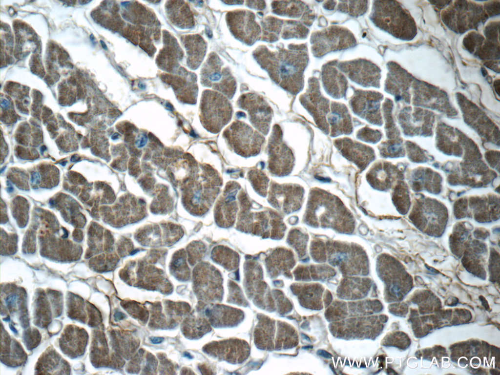 IHC staining of human heart using 10702-1-AP